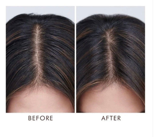Moroccanoil Oily Scalp Treatment – 45 ml